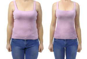 Woman wearing purple tank top showcasing tummy tuck before and after