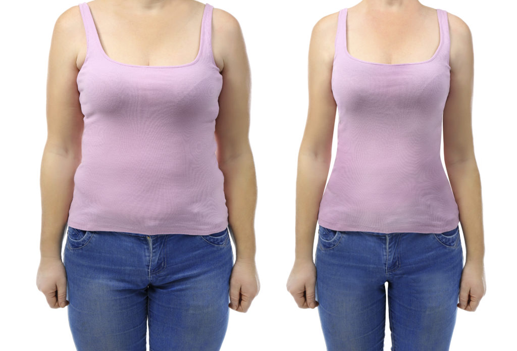 Woman wearing purple tank top showcasing tummy tuck before and after