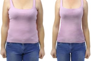 Woman wearing purple tank top showcasing tummy tuck before and after