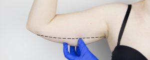 Woman arm being examined by medical professional