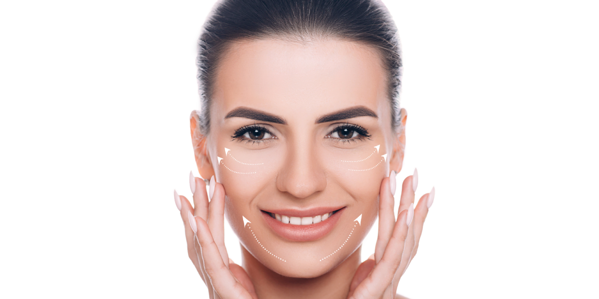 Facelift and Fillers